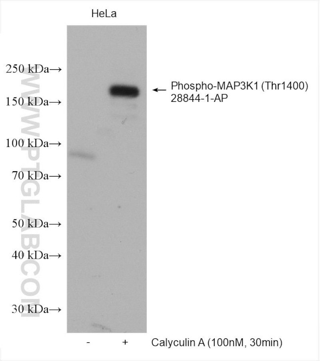 Phospho-MAP3K1 (Thr1400) Antibody in Western Blot (WB)