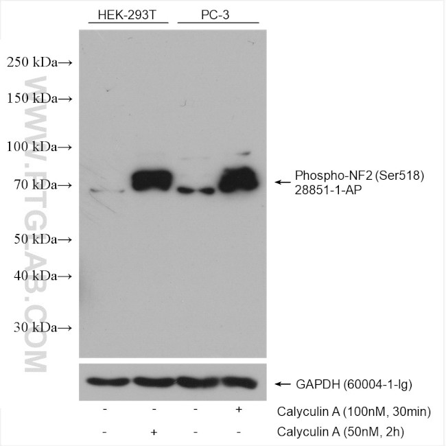 Phospho-NF2 (Ser518) Antibody in Western Blot (WB)