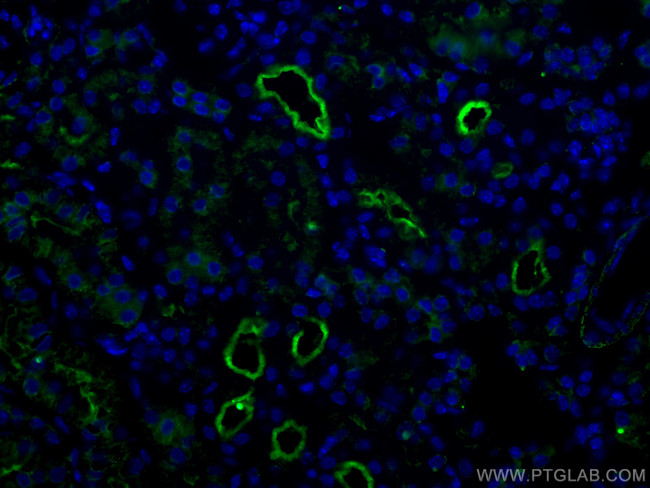 ACE2 Antibody in Immunohistochemistry (Paraffin) (IHC (P))