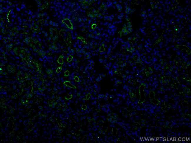 ACE2 Antibody in Immunohistochemistry (Paraffin) (IHC (P))