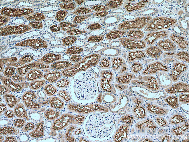 ACE2 Antibody in Immunohistochemistry (Paraffin) (IHC (P))