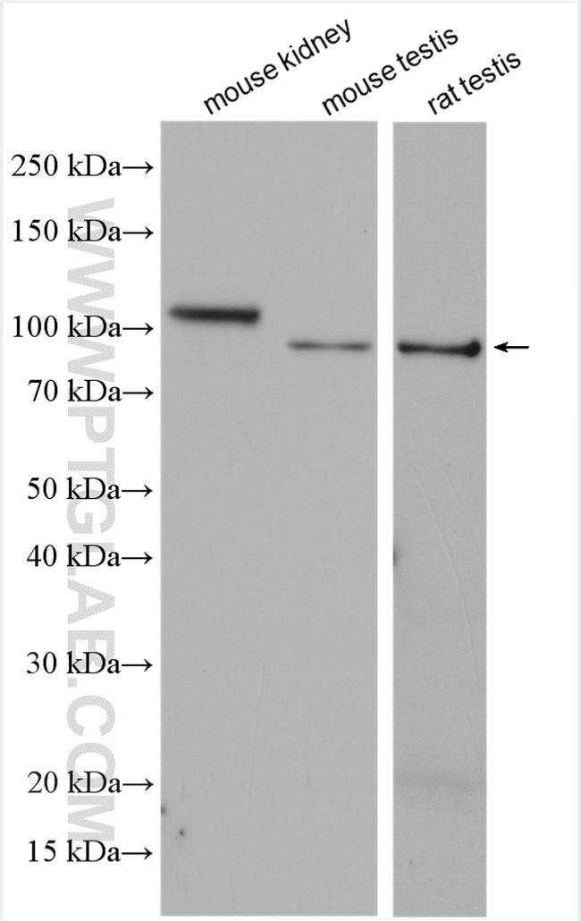 ACE2 Antibody in Western Blot (WB)