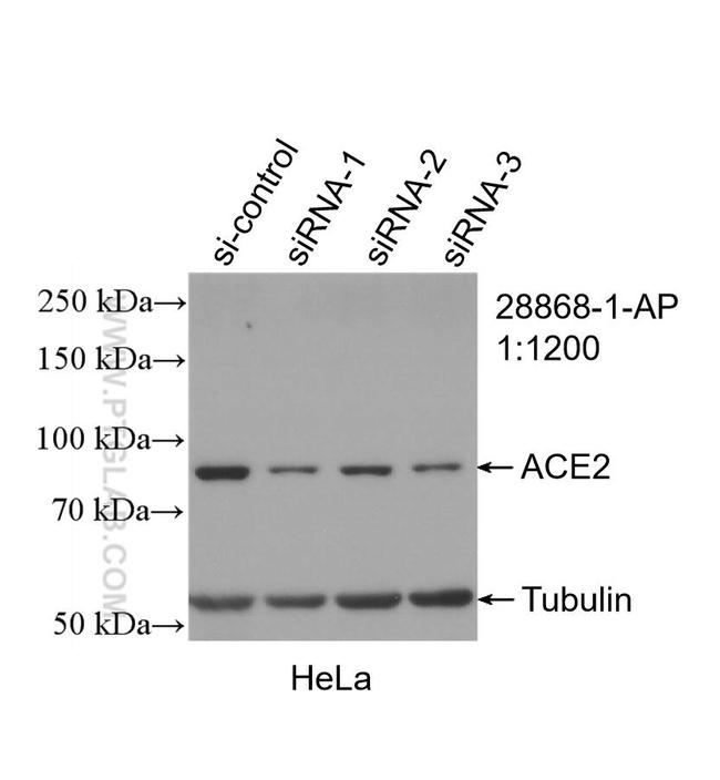 ACE2 Antibody in Western Blot (WB)