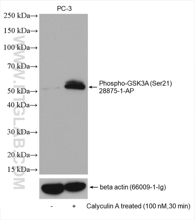 Phospho-GSK3A (Ser21) Antibody in Western Blot (WB)