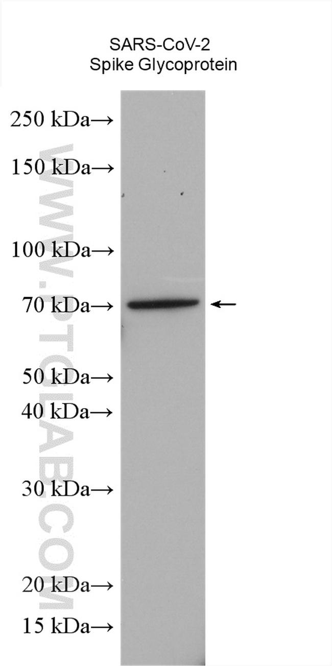 SARS-CoV-2 S protein (428-506 aa) Antibody in Western Blot (WB)