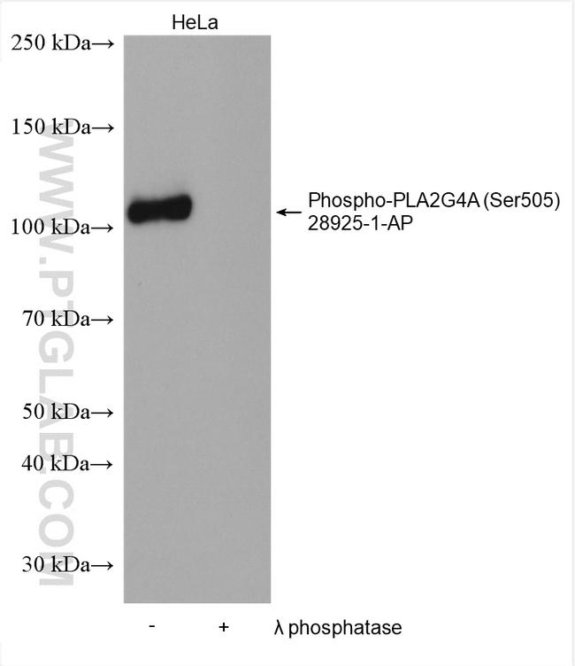 Phospho-PLA2G4A (Ser505) Antibody in Western Blot (WB)