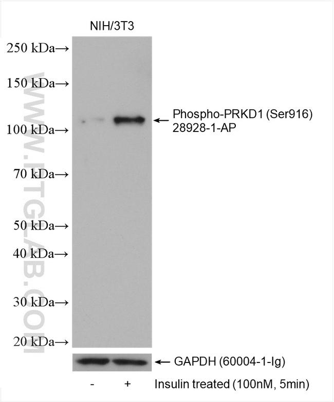 Phospho-PRKD1 (Ser916) Antibody in Western Blot (WB)