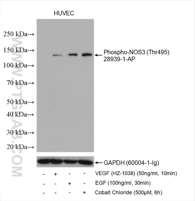 Phospho-NOS3 (Thr495) Antibody in Western Blot (WB)