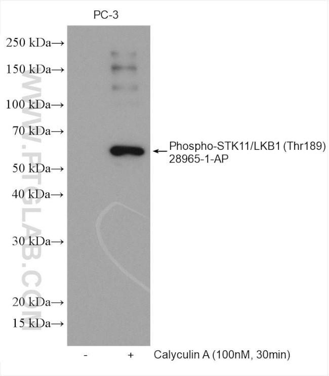 Phospho-STK11 (Thr189) Antibody in Western Blot (WB)