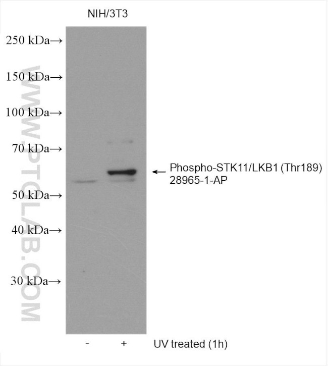 Phospho-STK11 (Thr189) Antibody in Western Blot (WB)