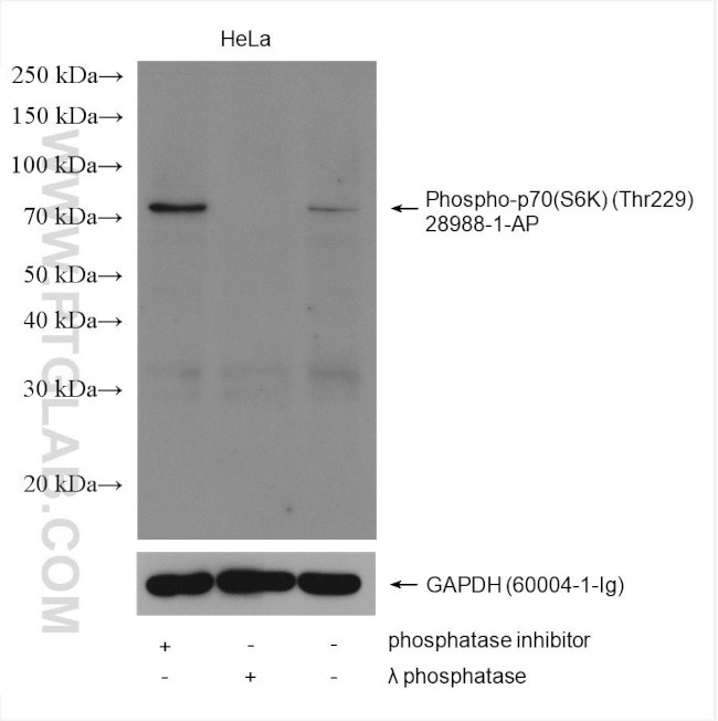 Phospho-p70 (S6K) (Thr229) Antibody in Western Blot (WB)