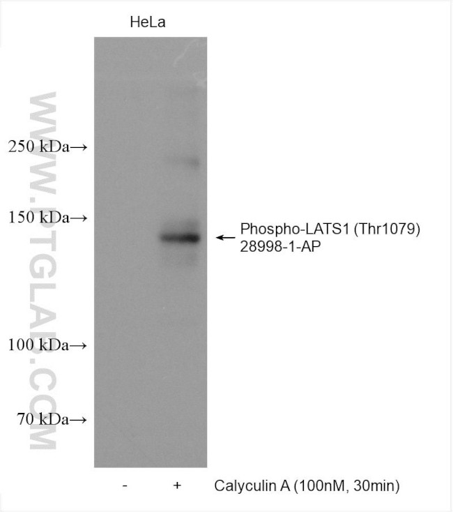 Phospho-LATS1 (Thr1079) Antibody in Western Blot (WB)