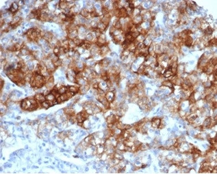 CD13/Aminopeptidase-N (Myeloid Cell Marker) Antibody in Immunohistochemistry (Paraffin) (IHC (P))