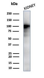 CD13/Aminopeptidase-N (Myeloid Cell Marker) Antibody in Western Blot (WB)