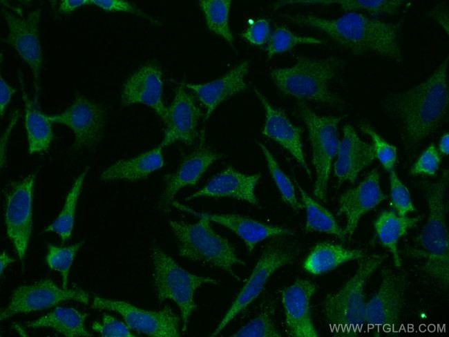 ULK1 Antibody in Immunocytochemistry (ICC/IF)