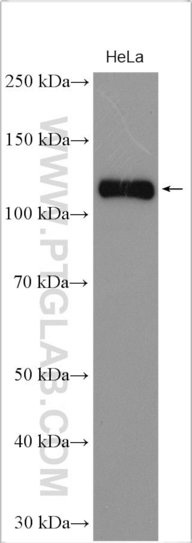 ULK1 Antibody in Western Blot (WB)