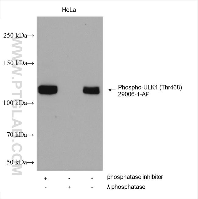 Phospho-ULK1 (Thr468) Antibody in Western Blot (WB)