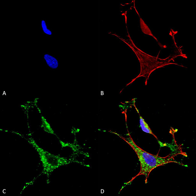 MMP9 Metalloproteinase Antibody in Immunocytochemistry (ICC/IF)