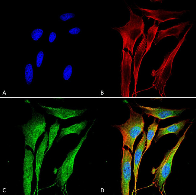 MMP9 Metalloproteinase Antibody in Immunocytochemistry (ICC/IF)