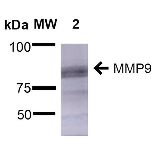 MMP9 Metalloproteinase Antibody in Western Blot (WB)