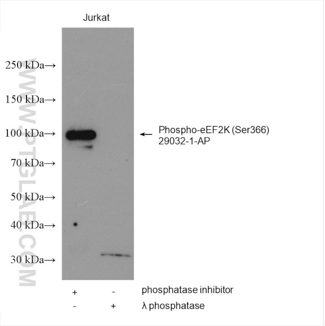 Phospho-eEF2K (Ser366) Antibody in Western Blot (WB)