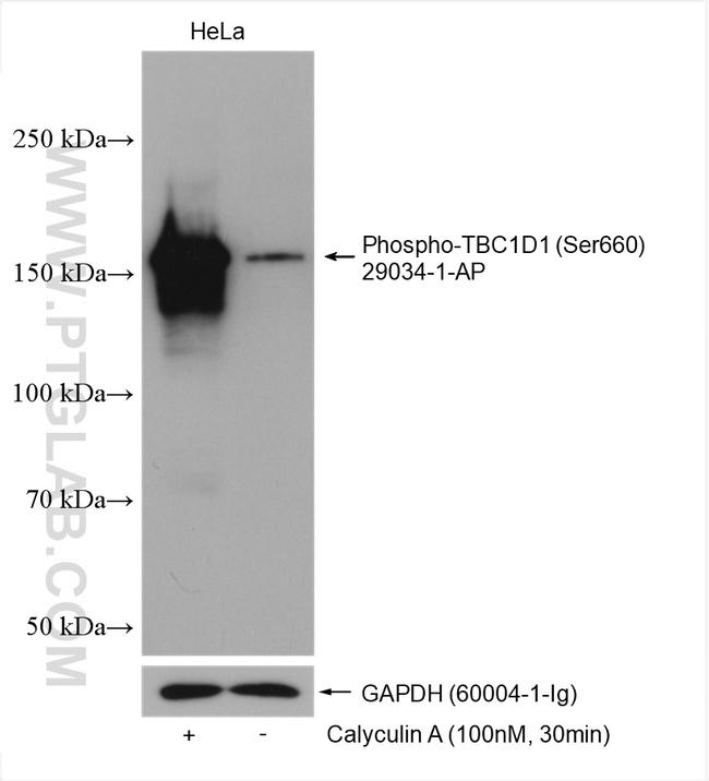 Phospho-TBC1D1 (Ser660) Antibody in Western Blot (WB)