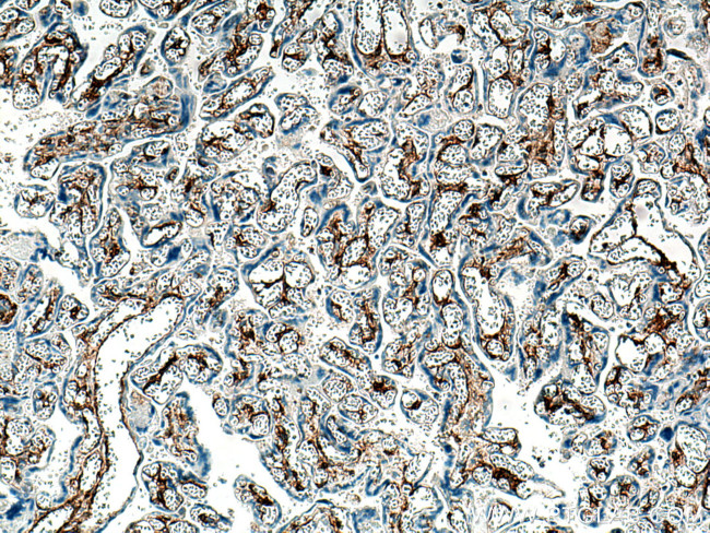 Integrin alpha-1 Antibody in Immunohistochemistry (Paraffin) (IHC (P))