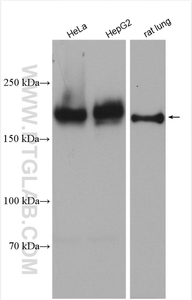 Integrin alpha-1 Antibody in Western Blot (WB)