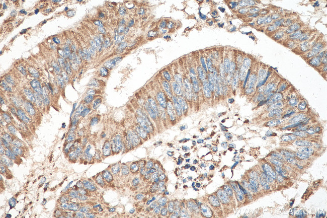 HADHB Antibody in Immunohistochemistry (Paraffin) (IHC (P))