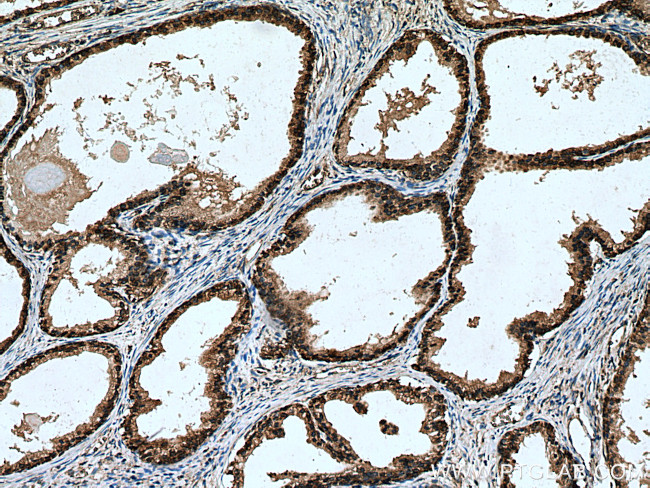 RPL5 Antibody in Immunohistochemistry (Paraffin) (IHC (P))