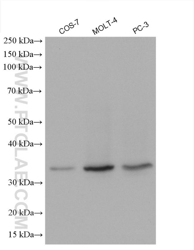 RPL5 Antibody in Western Blot (WB)