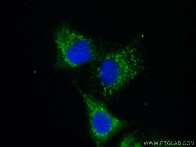 MMP14 Antibody in Immunocytochemistry (ICC/IF)