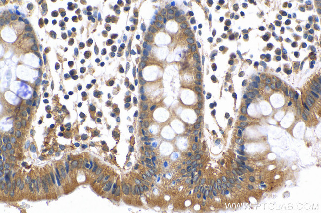 MMP14 Antibody in Immunohistochemistry (Paraffin) (IHC (P))