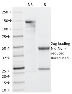 Galectin-13 (GAL13)/Placental Protein 13 (PP13) Antibody in SDS-PAGE (SDS-PAGE)