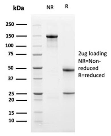 PD-L1/PDCD1LG1/CD274/B7-H1 (Cancer Immunotherapy Target) Antibody in SDS-PAGE (SDS-PAGE)