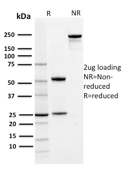 PD-L1/PDCD1LG1/CD274/B7-H1 (Cancer Immunotherapy Target) Antibody in SDS-PAGE (SDS-PAGE)