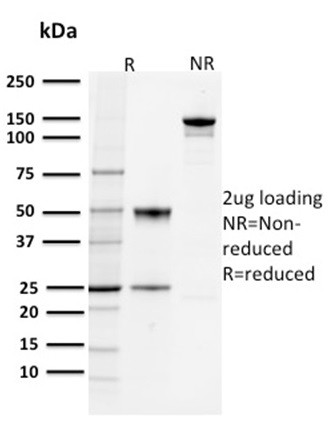 PD-L1/PDCD1LG1/CD274/B7-H1 (Cancer Immunotherapy Target) Antibody in SDS-PAGE (SDS-PAGE)