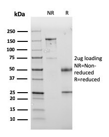 PD-L1/PDCD1LG1/CD274/B7-H1 (Cancer Immunotherapy Target) Antibody in SDS-PAGE (SDS-PAGE)