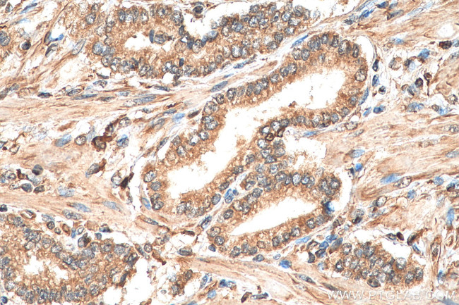 MAP3K7 Antibody in Immunohistochemistry (Paraffin) (IHC (P))