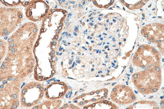 PADI2 Antibody in Immunohistochemistry (Paraffin) (IHC (P))