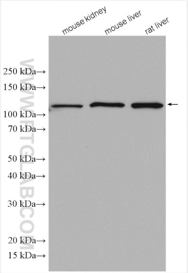 GANAB Antibody in Western Blot (WB)