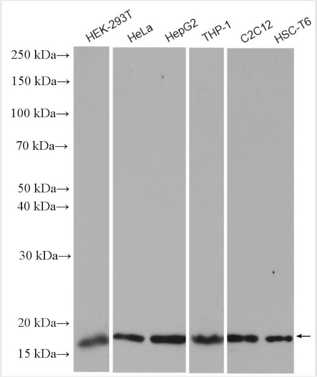 H3K36me2 Antibody in Western Blot (WB)