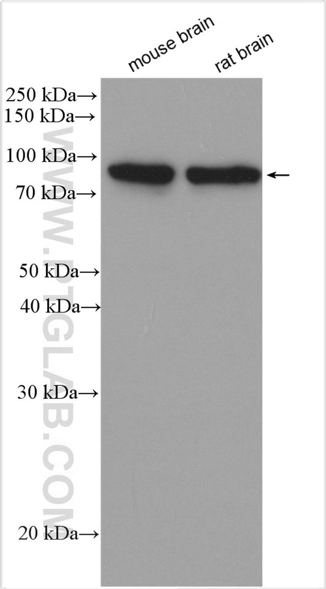 PKC Gamma Antibody in Western Blot (WB)