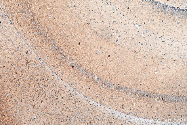 nNOS Antibody in Immunohistochemistry (Paraffin) (IHC (P))