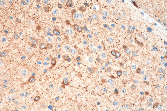 nNOS Antibody in Immunohistochemistry (Paraffin) (IHC (P))