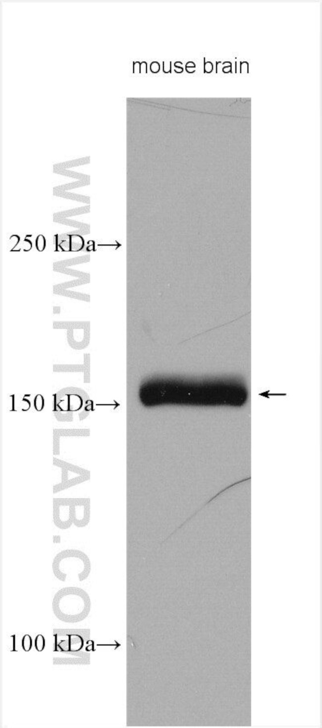 nNOS Antibody in Western Blot (WB)