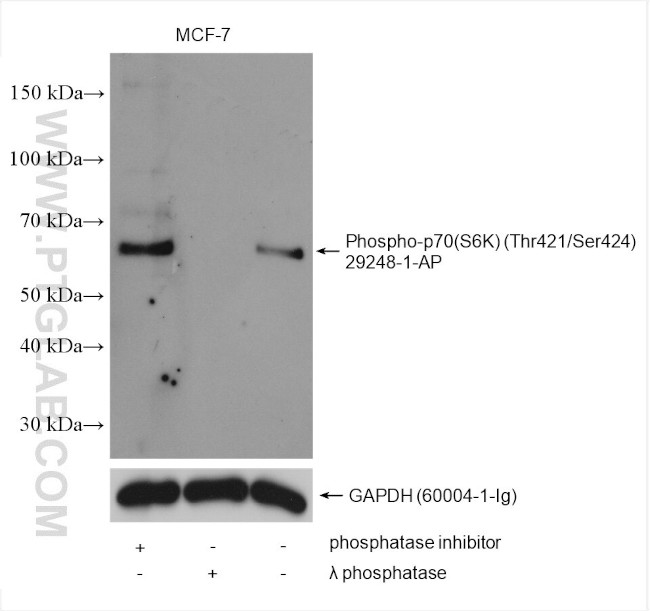Phospho-p70 (S6K) (Thr421, Ser424) Antibody in Western Blot (WB)