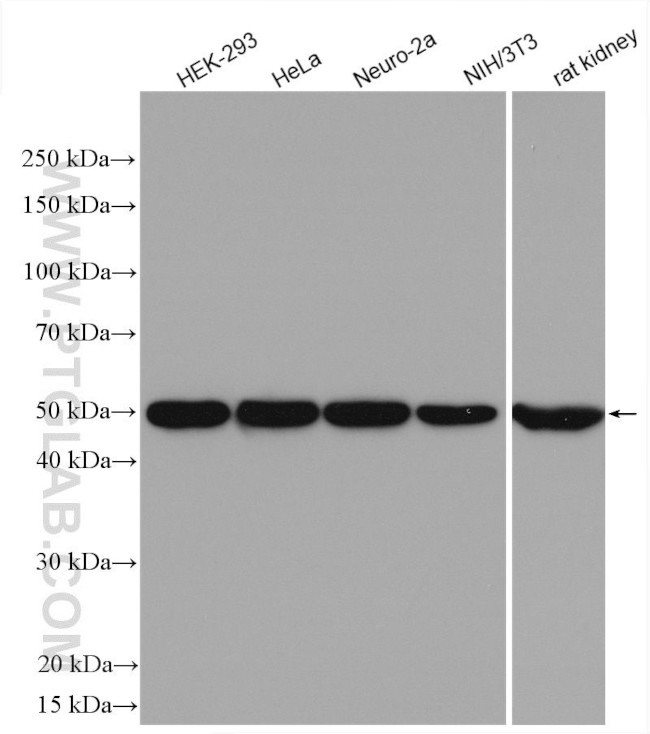 NADK Antibody in Western Blot (WB)