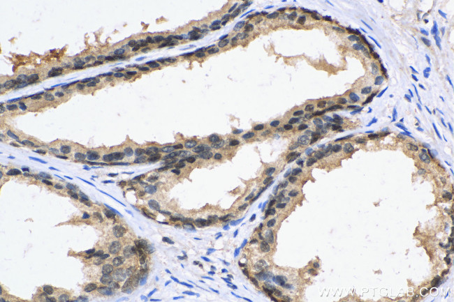 PCNP Antibody in Immunohistochemistry (Paraffin) (IHC (P))