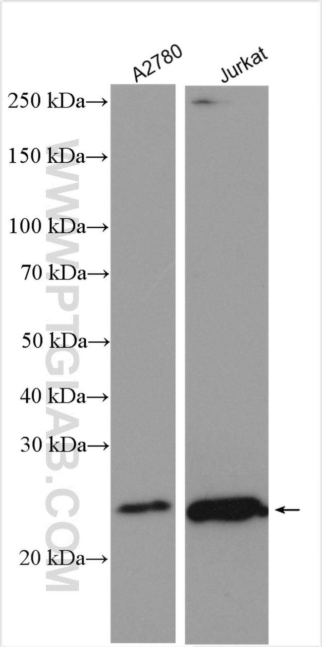 PCNP Antibody in Western Blot (WB)